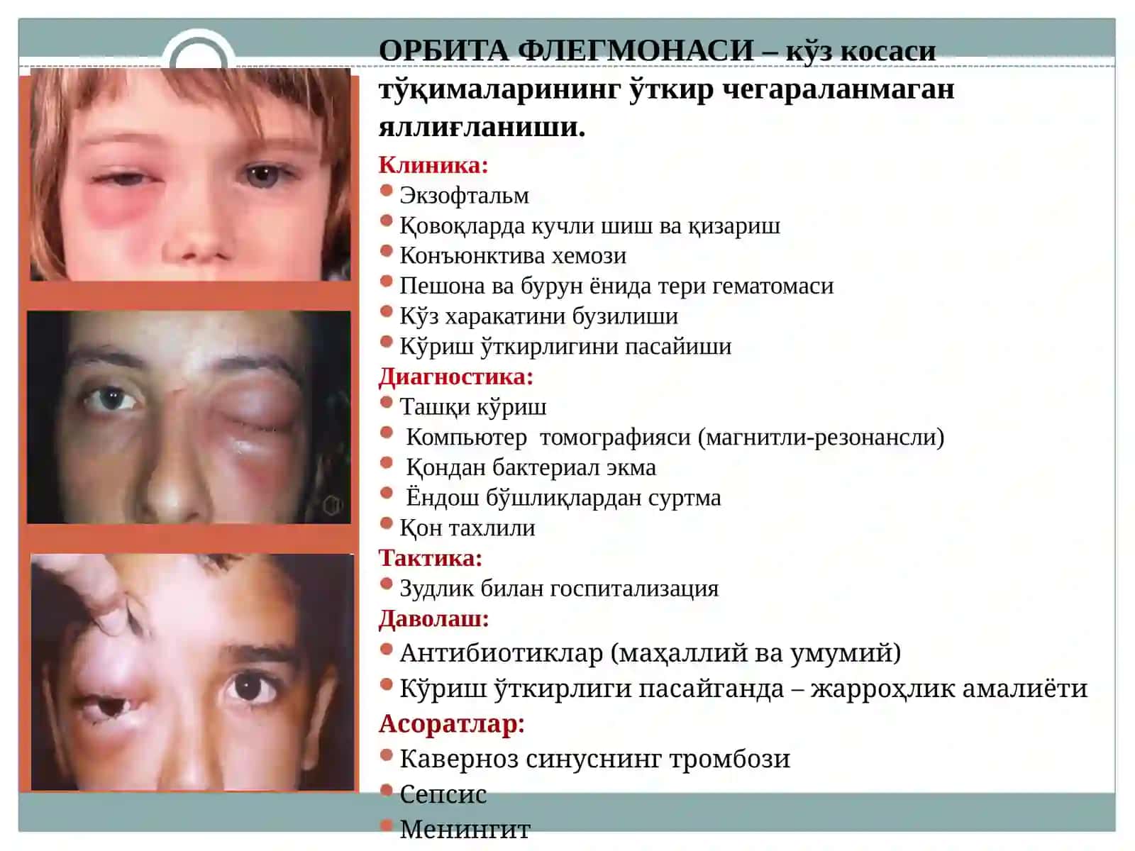 КЎРУВ АЪЗОСИ ЯЛЛИҒЛАНИШ КАСАЛЛИКЛАРИ 4