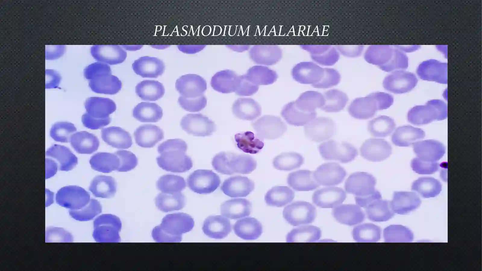 Plasmodium malariae 4