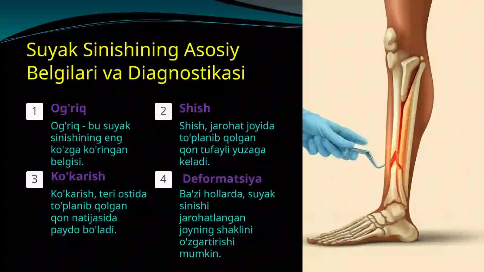 Suyak Sinishida Zamonaviy Davolash Usullari 4
