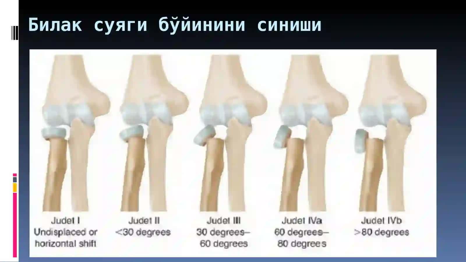 БИЛАК СУЯКЛАРИ ЖАРОХАТИ 4