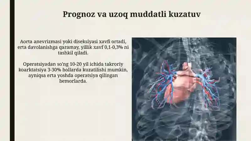 Aorta koarktatsiyasi 4