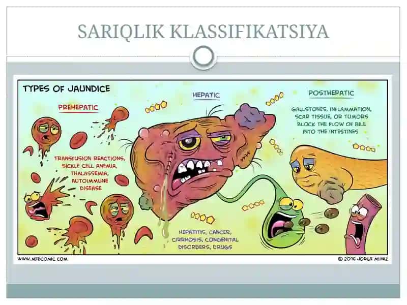 Sariqlik 4