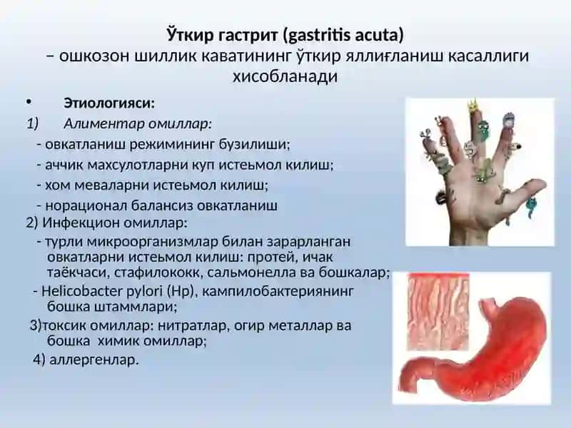 Ошқозон-ичактрактининг сурункали касалликлари 4