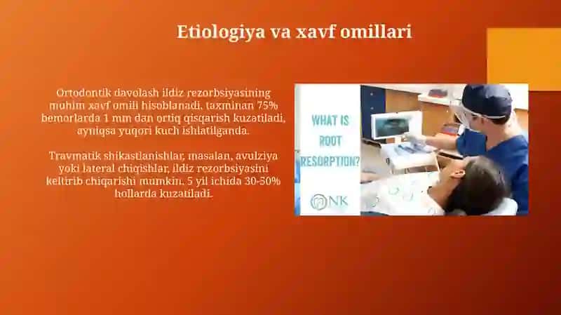 Ildiz rezorbsiyasi 4