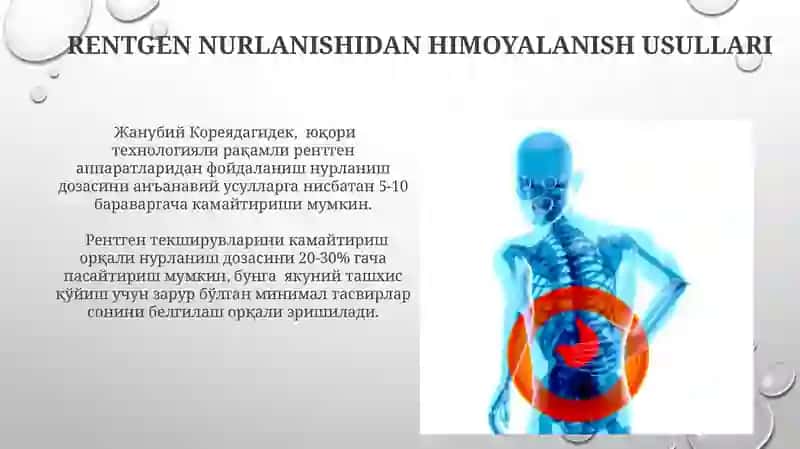 Rentgen nurlar va ularni organizmga ta'siri 4