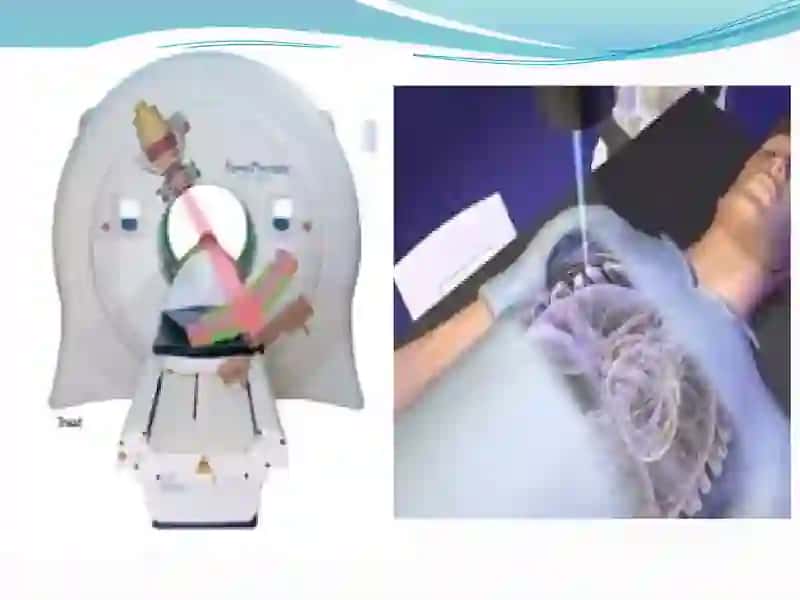 Radiologiya 4