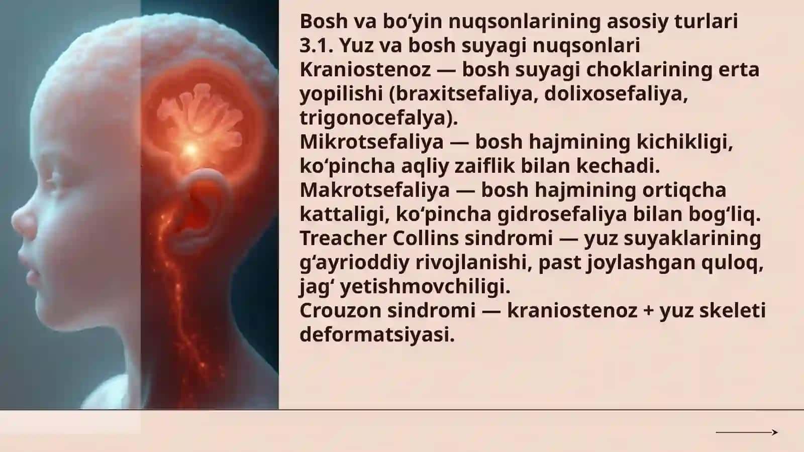 Bosh va bo'yin tuģma rivojlanish nuqsonlari 4