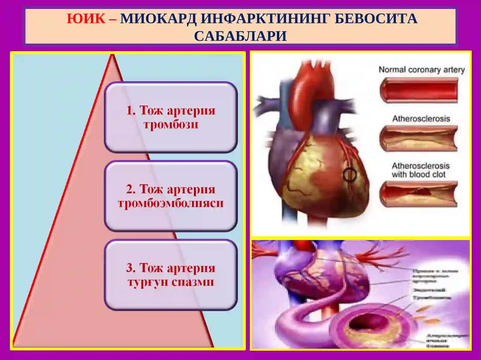 ЮРАК ИШЕМИК КАСАЛЛИГИ - ЮИК 4