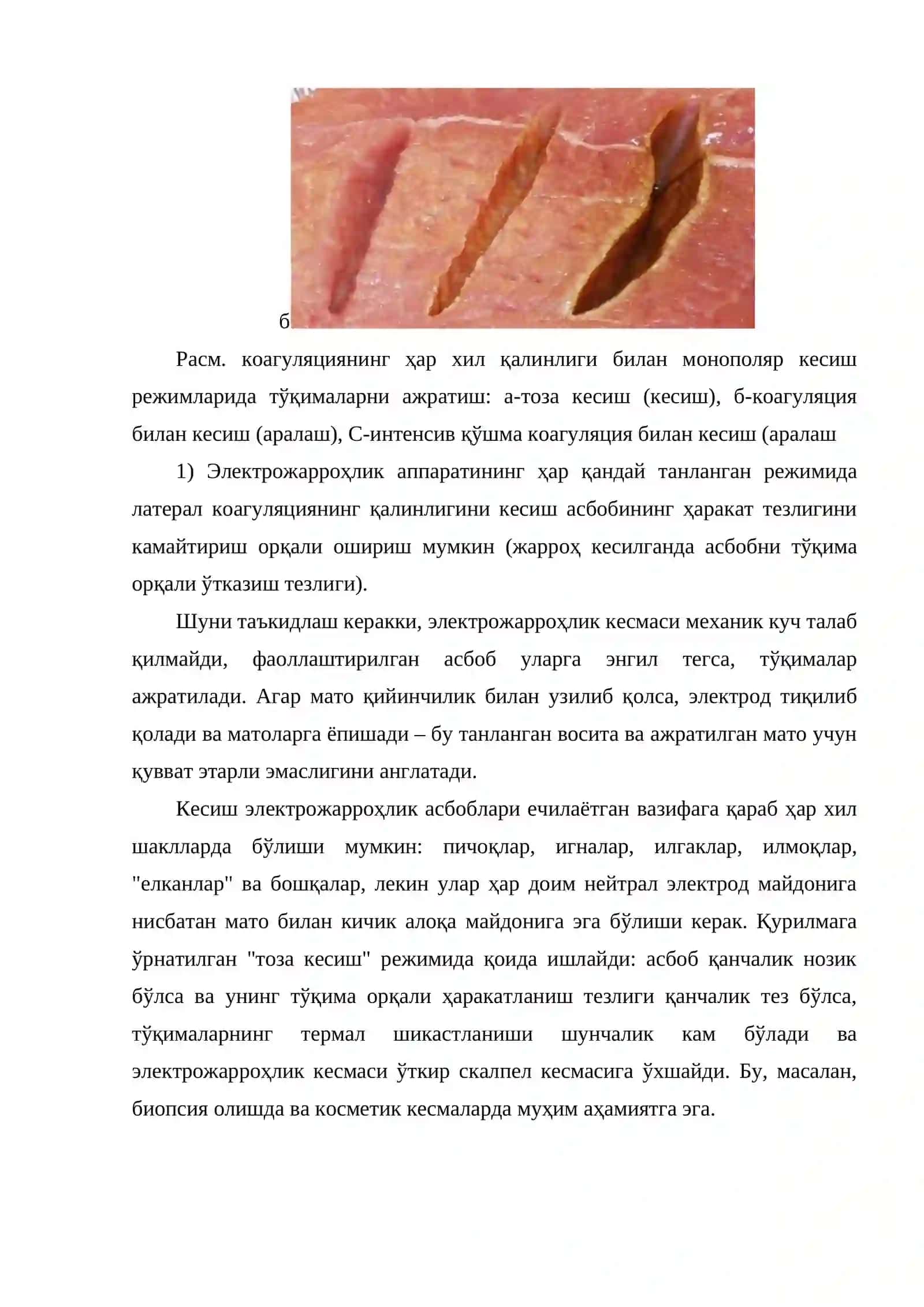 Электрожарроҳлик-усулнинг тамойиллари ва асослари 4
