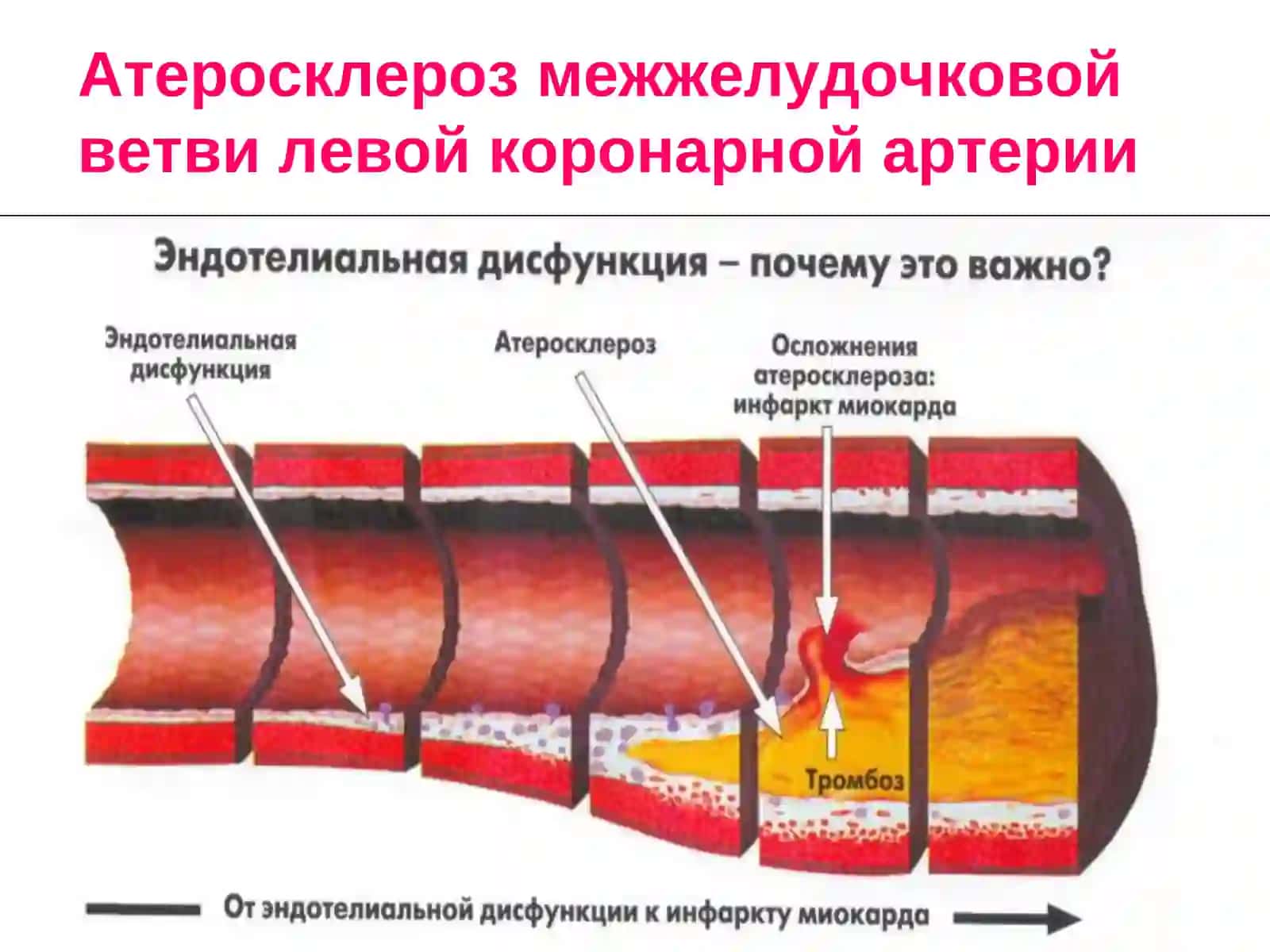 Средства, применяемые при недостаточности коронарного кровообращения 4