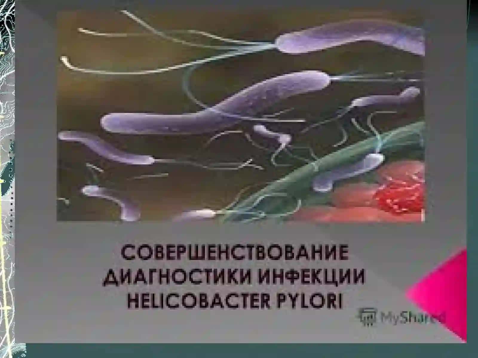 Язвенная болезнь желудка и ДПК 4