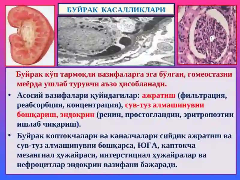 Буйрак касалликлари 4