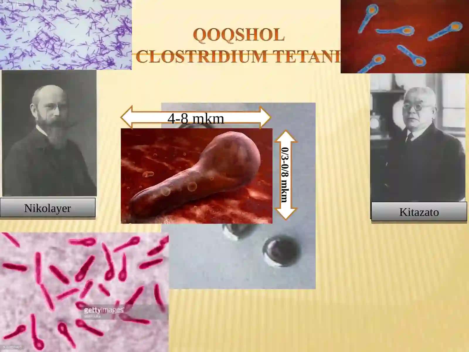 Patogen anaeroblar. Qoqshol, gazli gangrena qoʼzgʼatuvchilari va ularning biologik xususiyatlari 4