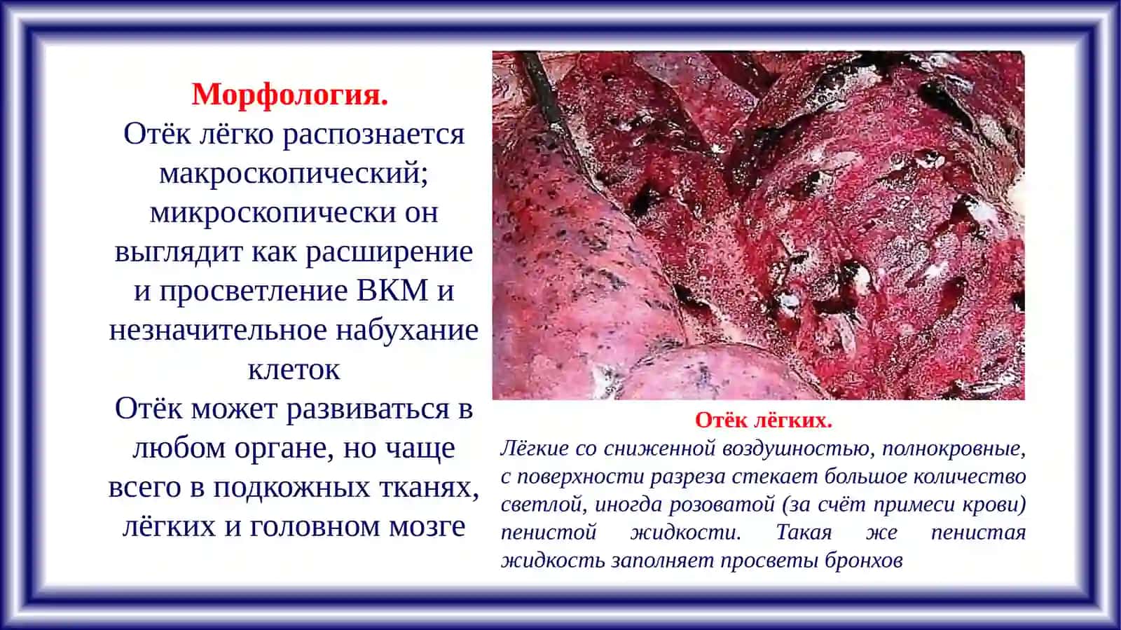ПАТОЛОГИЧЕСКАЯ АНАТОМИЯ И СУДЕБНАЯ МЕДИЦИНА 4