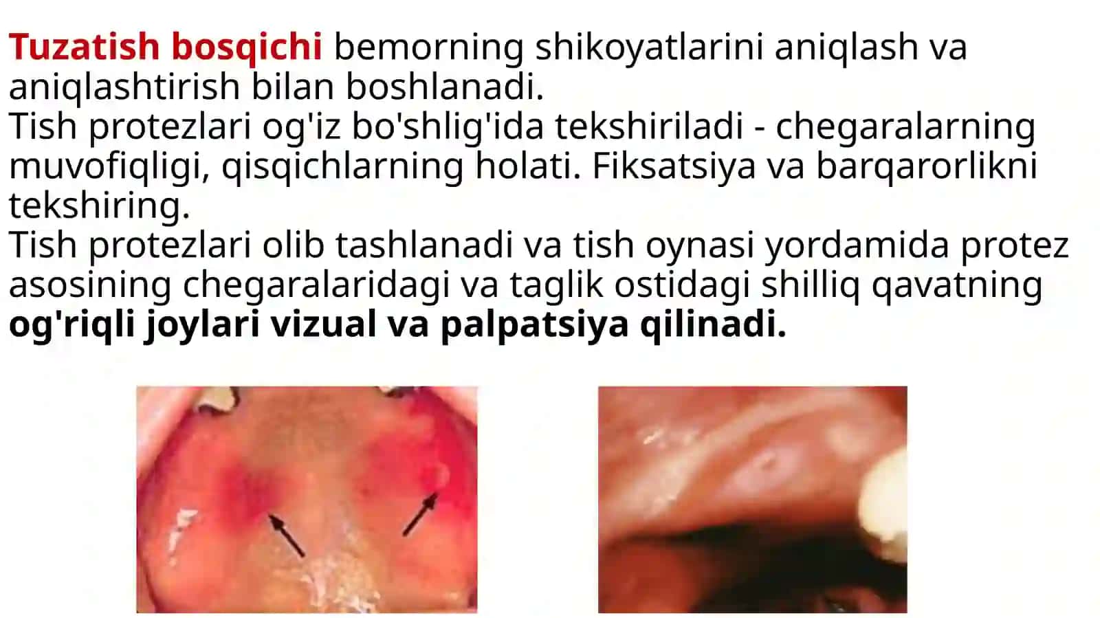 Korreksiyalash asoslari 4