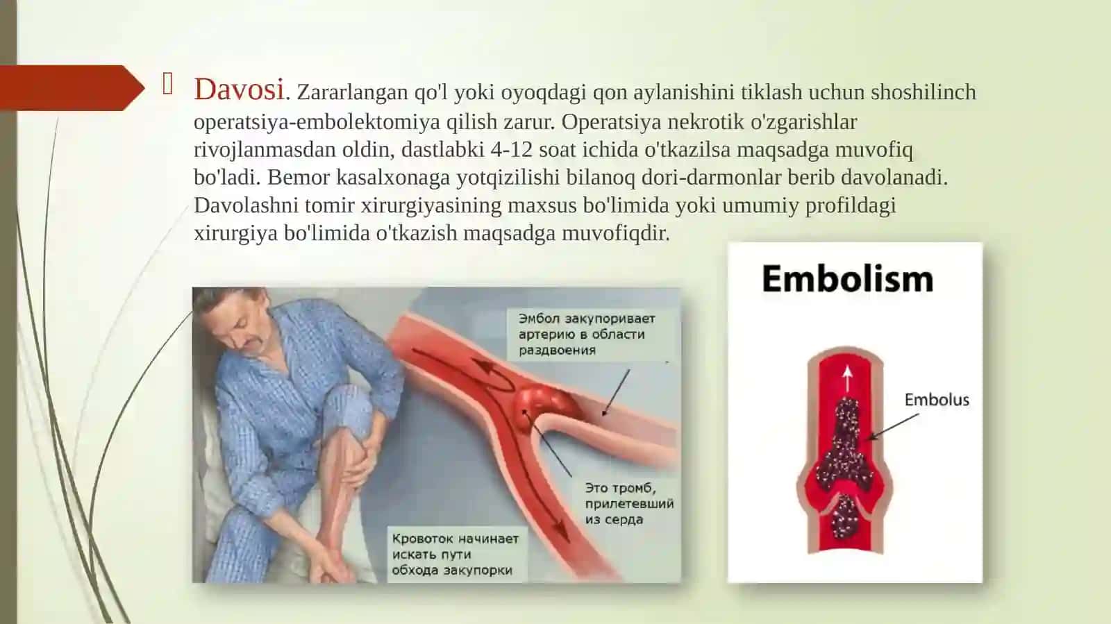 TrombozvaEmboliyalar 4