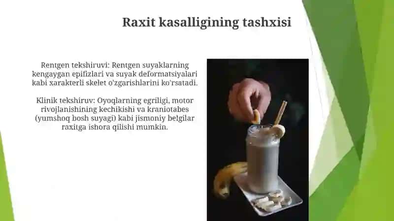 Raxit kasalligi 4