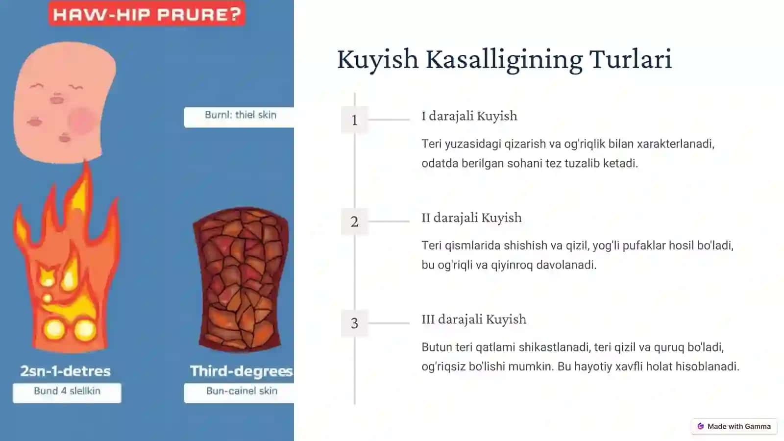 Kuyish kasaligi 4