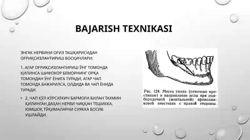 Mental Nervni Ogʻriqsizlantirish 4