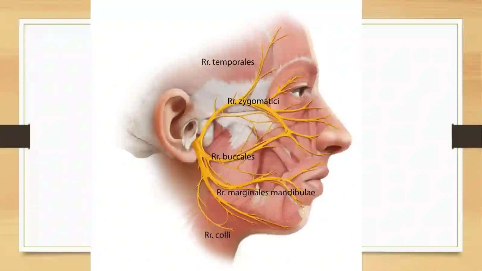 NERVUS FACIALIS 4