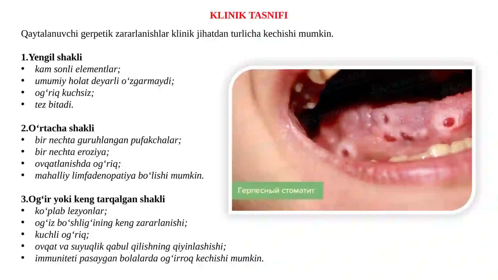 BOLALARDA QAYTALANUVCHI GERPETIK STOMATIT 4