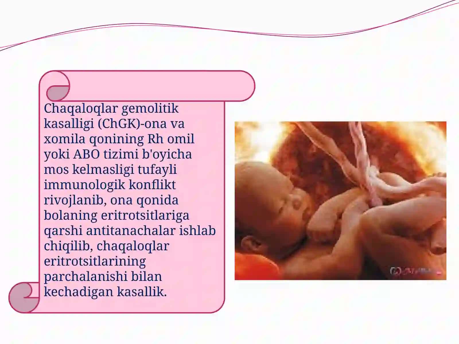 Chaqaloqlar gemolitik kasalligi (ChGK) xaqida tushuncha 4
