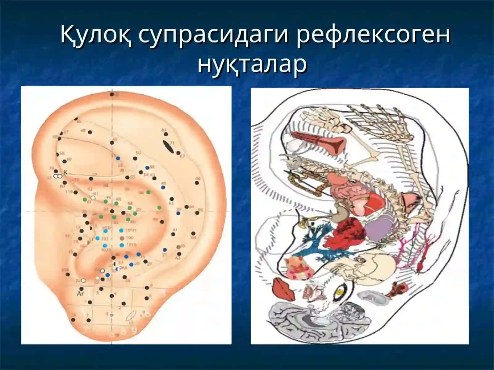 OTOGENIC INTRACRANIAL COMPLICATIONS. NONSUPPURATIVE EAR INFECTIONS. CHRONIC CATARRH OF THE MIDDLE EAR. SENSORINEURAL HEARING LOSS. OTOSCLEROSIS. MENIERE'S DISEASE 4