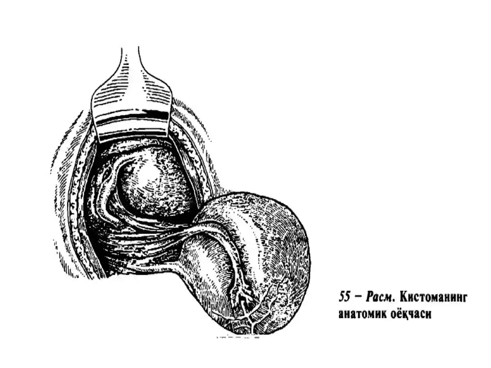 KISTOMA 4