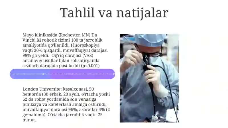 Robotlashtirilgan xirurgiya amaliyoti 4