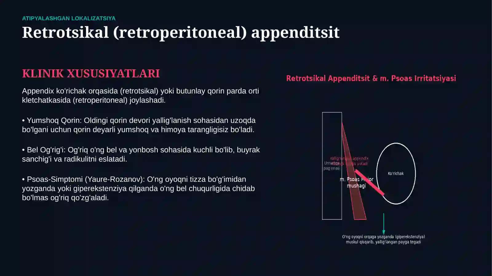 O‘TKIR APPENDITSITNING ATIPIK KECHISHI — KLINIK BELGILARI, TASHXISI VA DAVOLASH | 15 SLAYDLI TAQDIMO 4