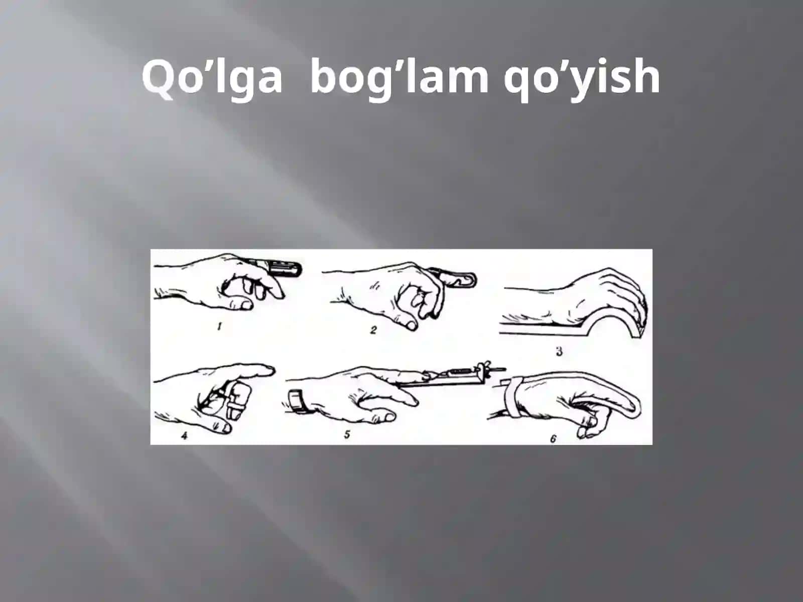 Desmurgiyavatransportimmobilizatsiyasi 4