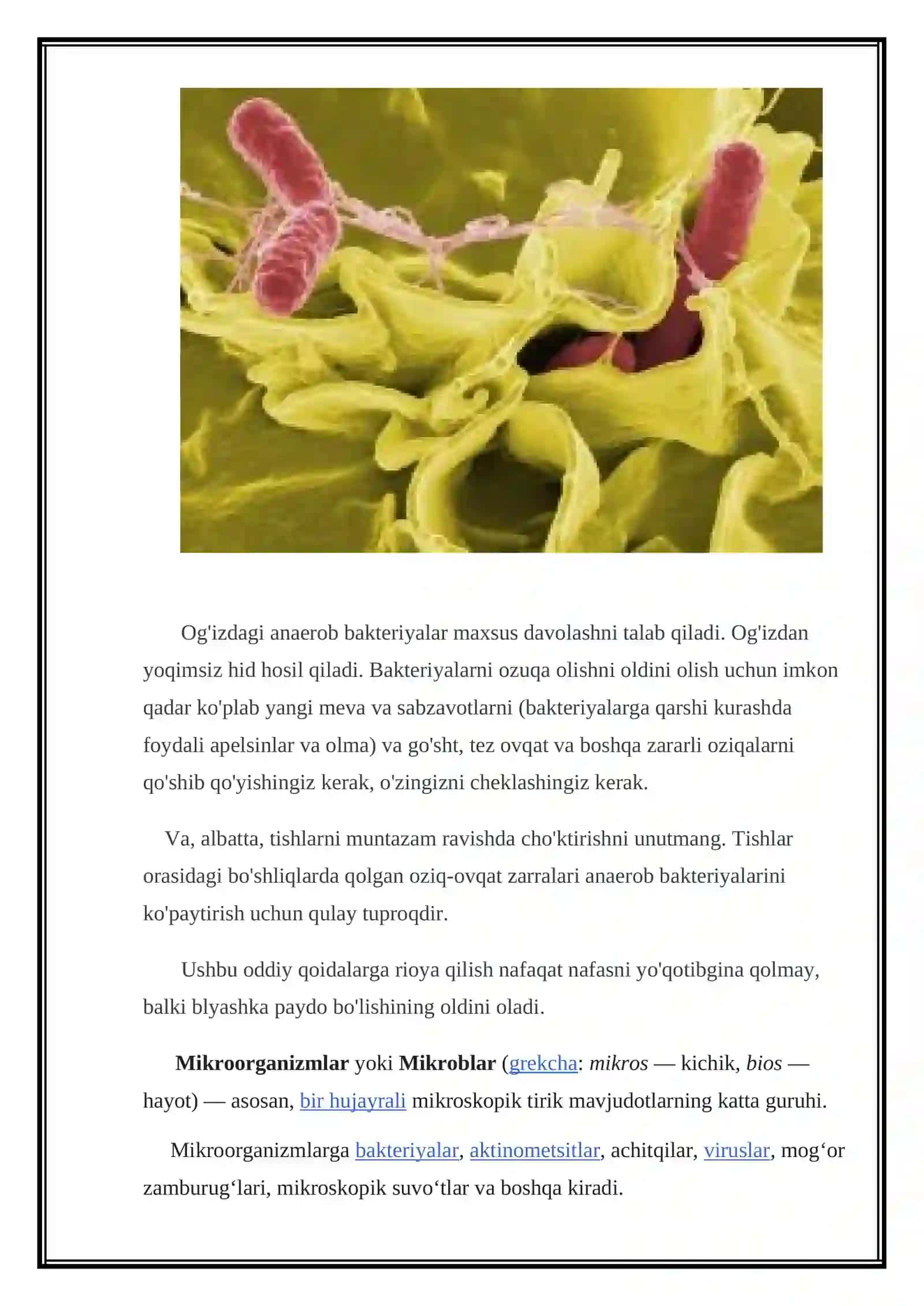 ANAEROB INFEKSIYALAR QO'ZG'ATUVCHILARI 4