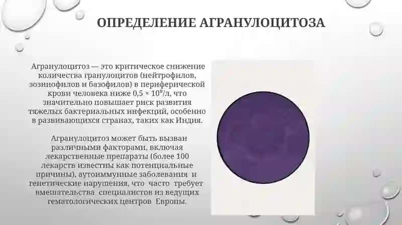 Агранулацитоз 4