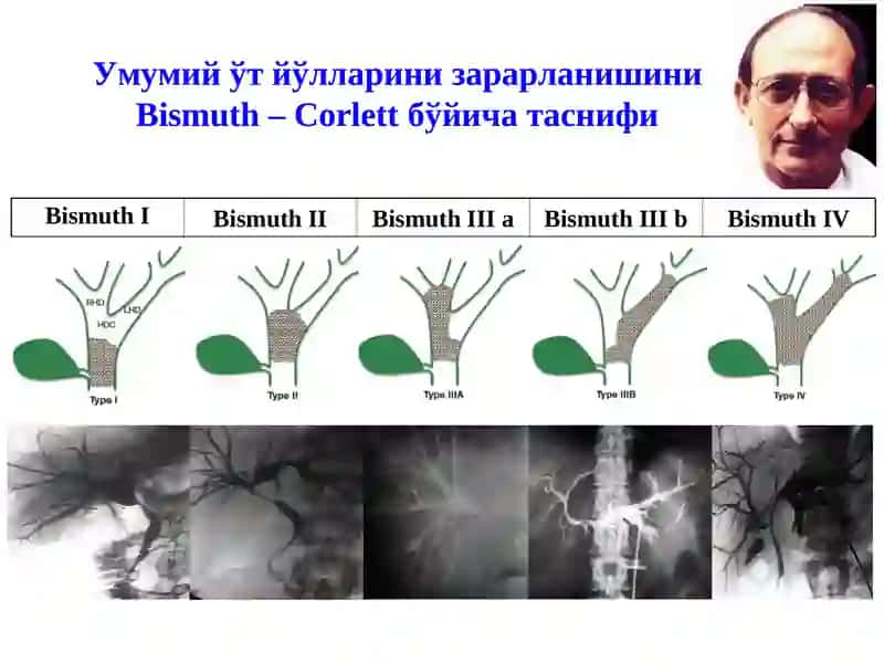 Жигардан ташқари ўт йўллари анатомияси 4