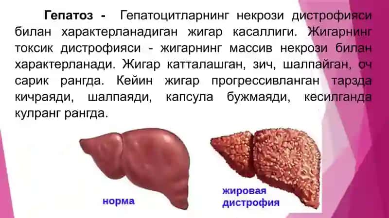 Гепатоз 4