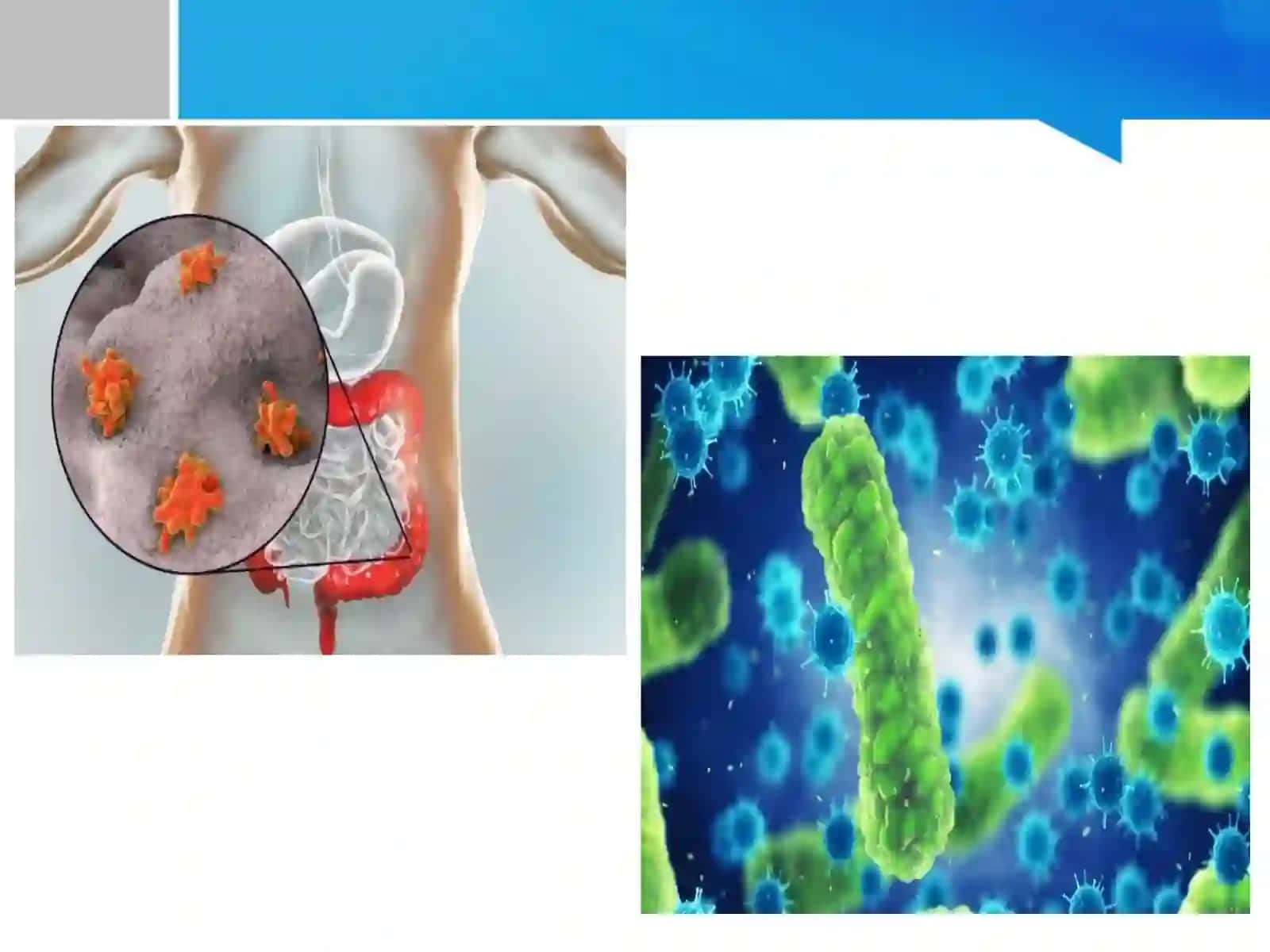 Differentsial`-diagnostik (Endo, Levina, Ploskireva, VSA) muxitlariga najasni ekish temadan prezinta 4
