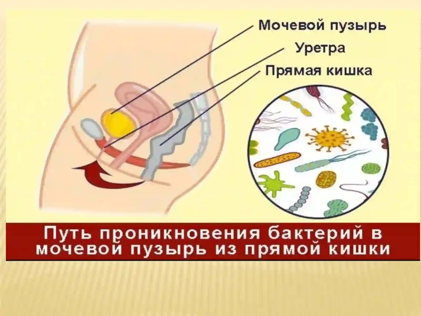 Siydik tanosil a’zolarining nospetsifik infeksion qo’zg’atuvchilari.Patogenezi.Labaratoriya tashxisi 4
