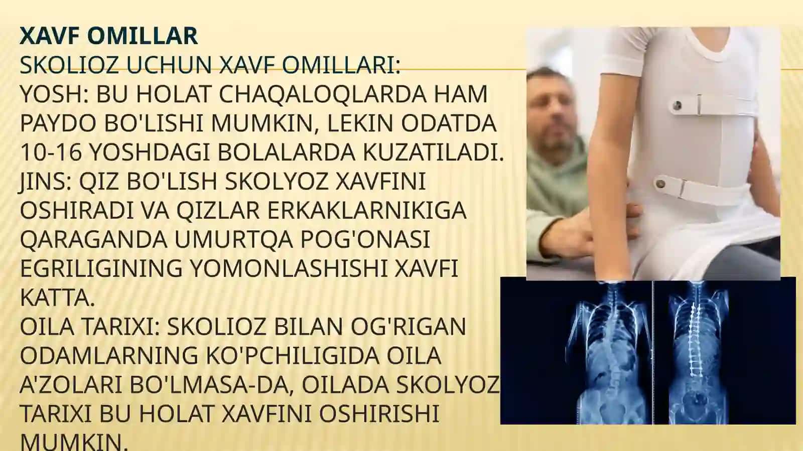 Skolioz: klinikasi, tasnifi va davolash. Oyoq o'qi deformatsiyalari 4