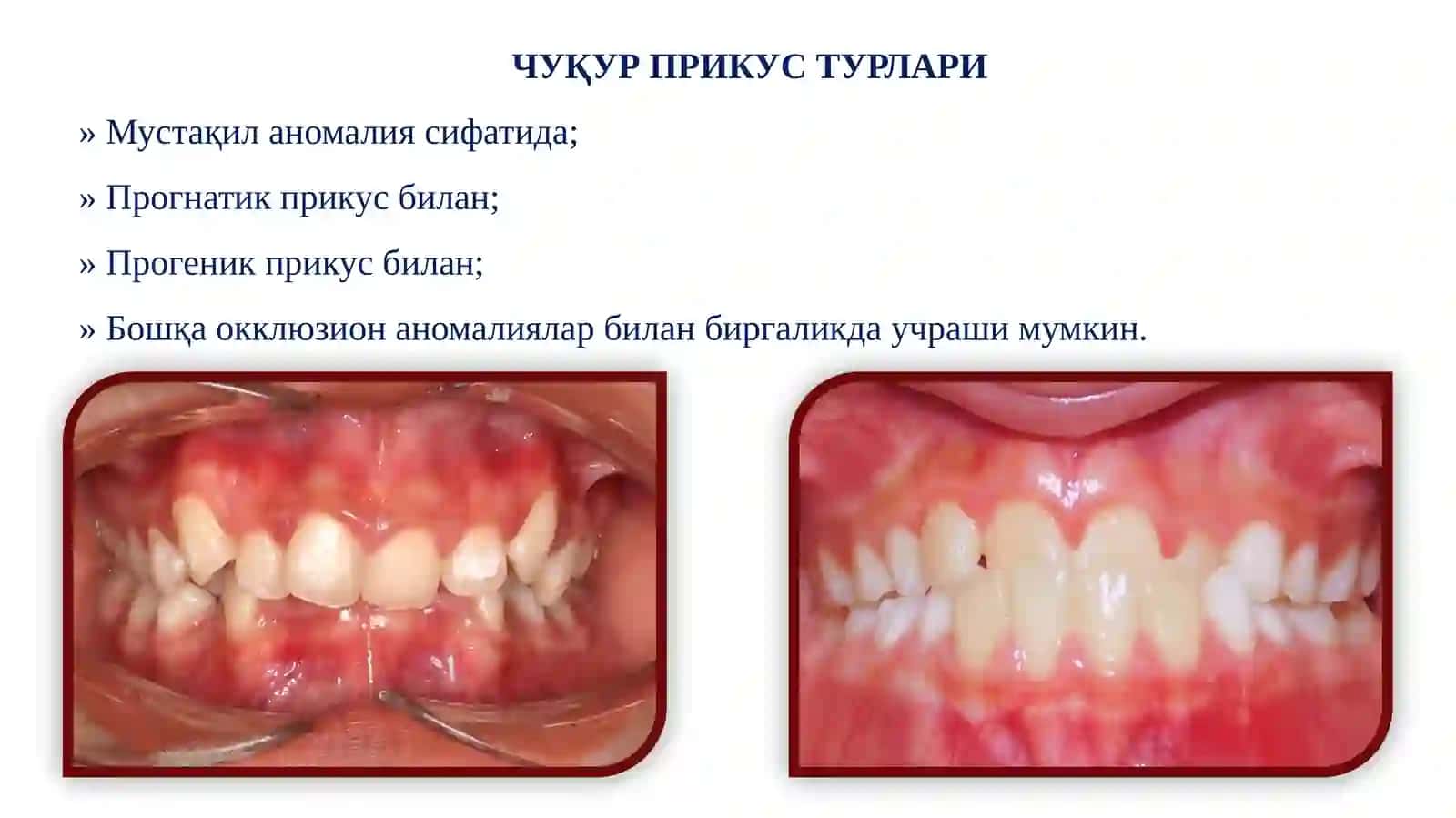 ЧУҚУР ПРИКУС. ЭТИОЛОГИЯСИ, ПАТОГEНEЗИ ВА КЛИНИКАСИ, ТАШХИСЛАШ ВА ДАВОЛАШ 4