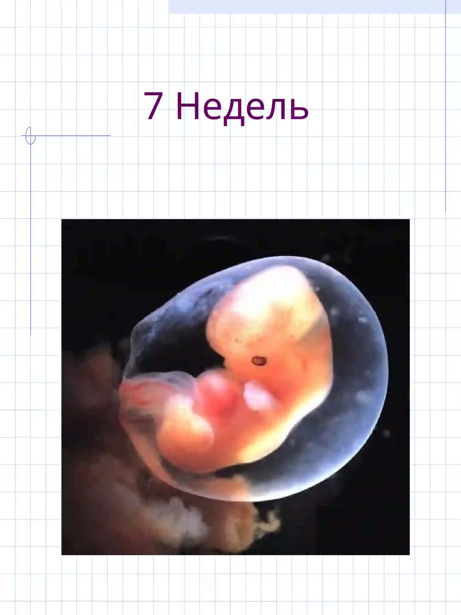 Оказание неотложной помощи новорожденному при родах вне стационара 4