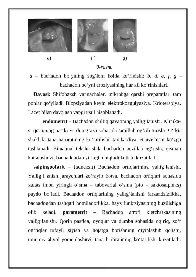 Ayollar jinsiy a'zolari spesifik va nospesifik kasalliklari 4