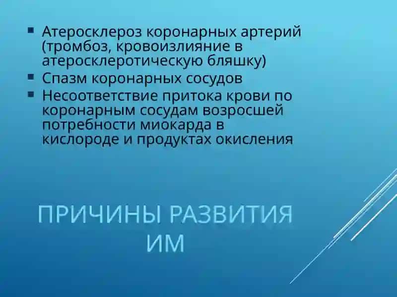 Инфаркт миокарда 4