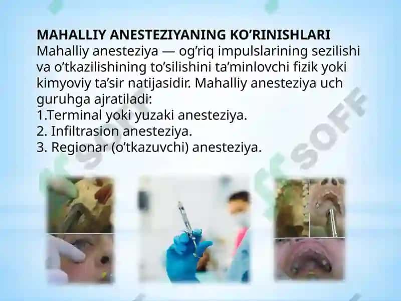 Oʻtkazuvchi ogʻriqsizlantirish texnikasi va uniasoslash 4
