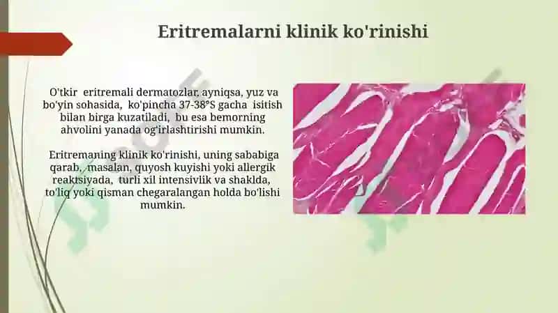 Eritmalar haqida tushuncha, sinflanishi, konsintiratsiyasi 4