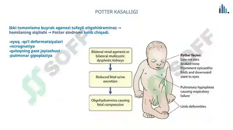 Renal Panalogiya 4