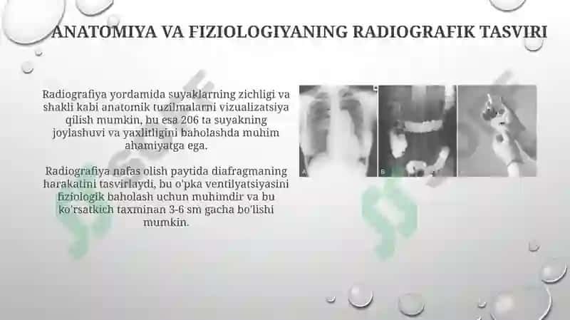 Radiografiya asoslari va texnikasi 4
