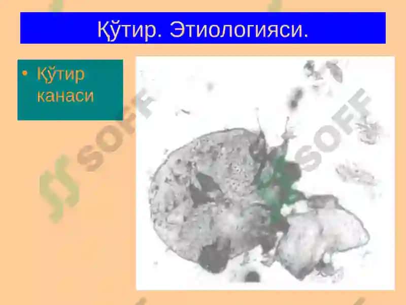 Терининг Паразитар Касалликлари 4