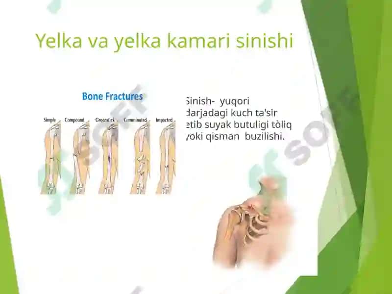 Yelka va Yelka kamari shikastlanishi 4