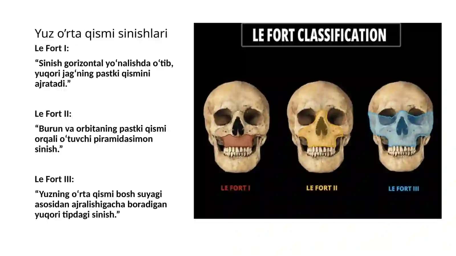Fragmentlarsiljishinikorsatadi 4