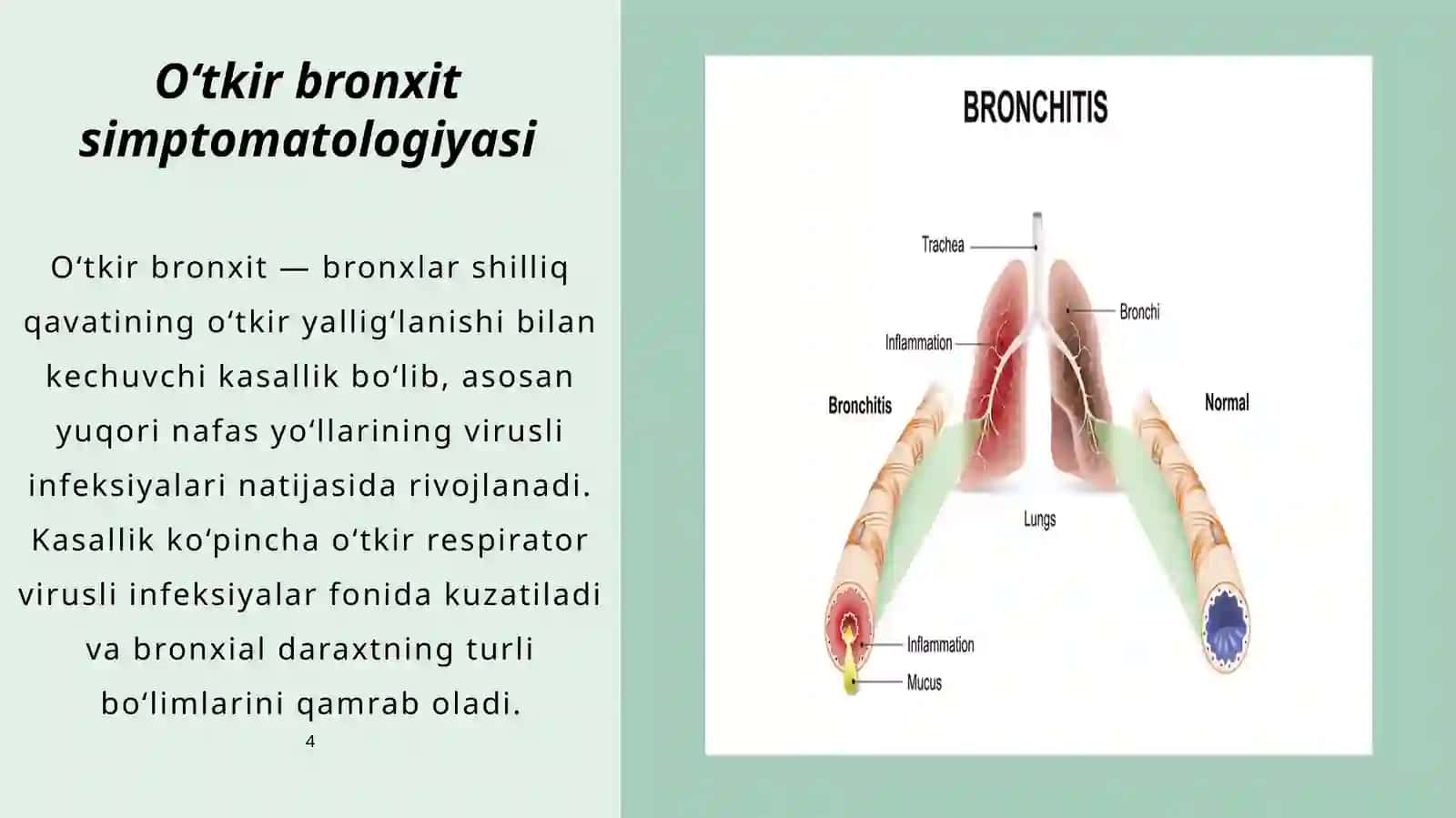 Bronxlar o‘tkazuvchanligining buzilishi sindromi 4